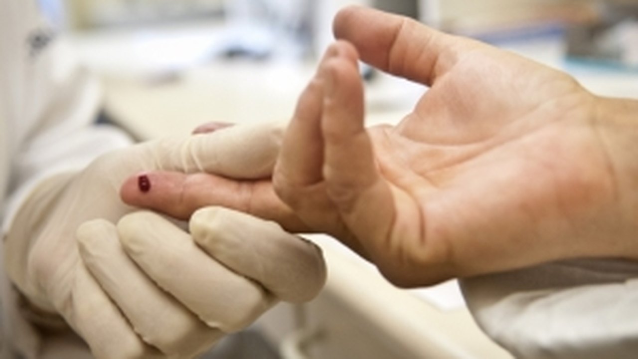 Tratamento precoce é a saída para reduzir incidência do HIV