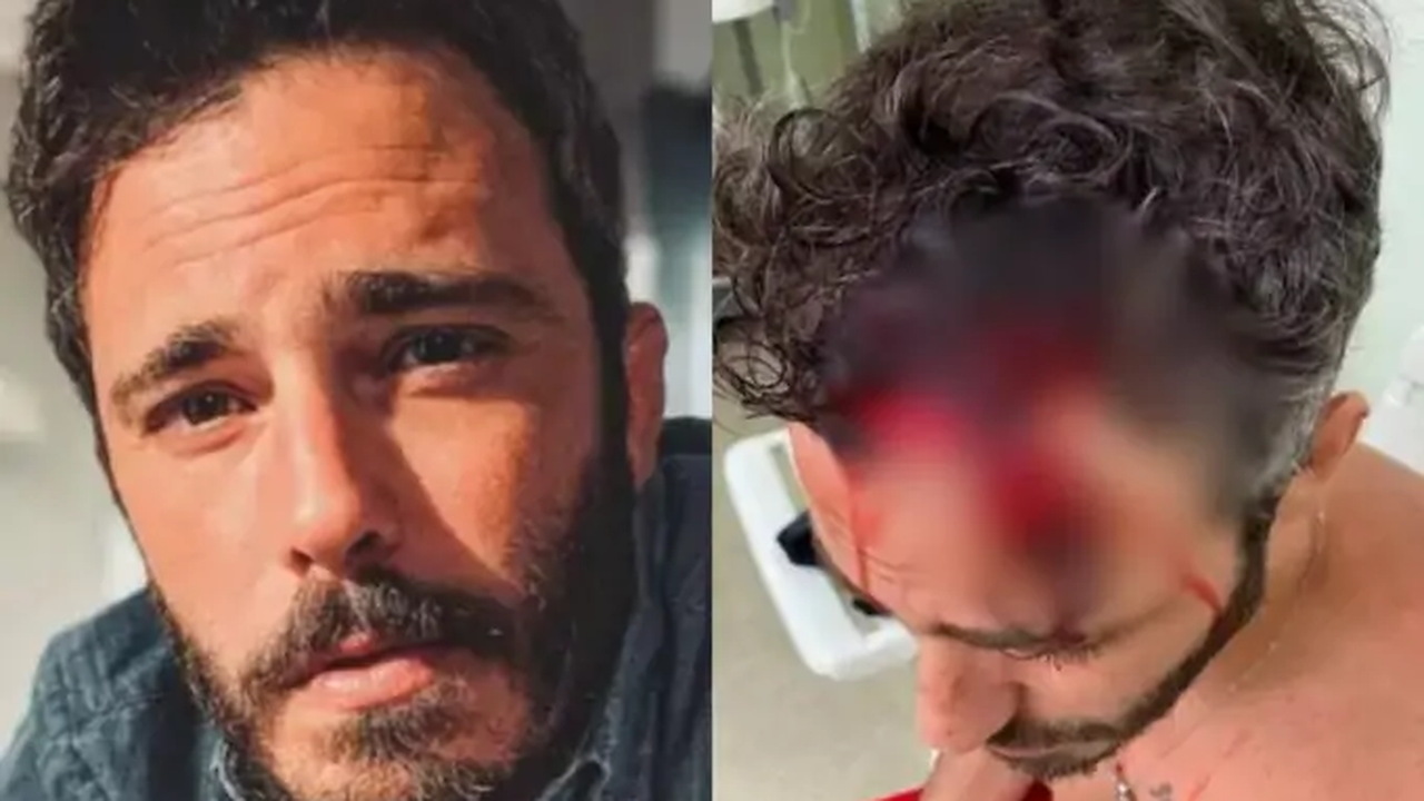 Ator Thiago Rodrigues é agredido em assalto na zona sul do Rio