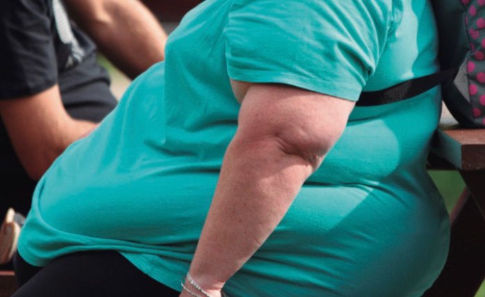 Aumento da obesidade entre adultos em Alagoas