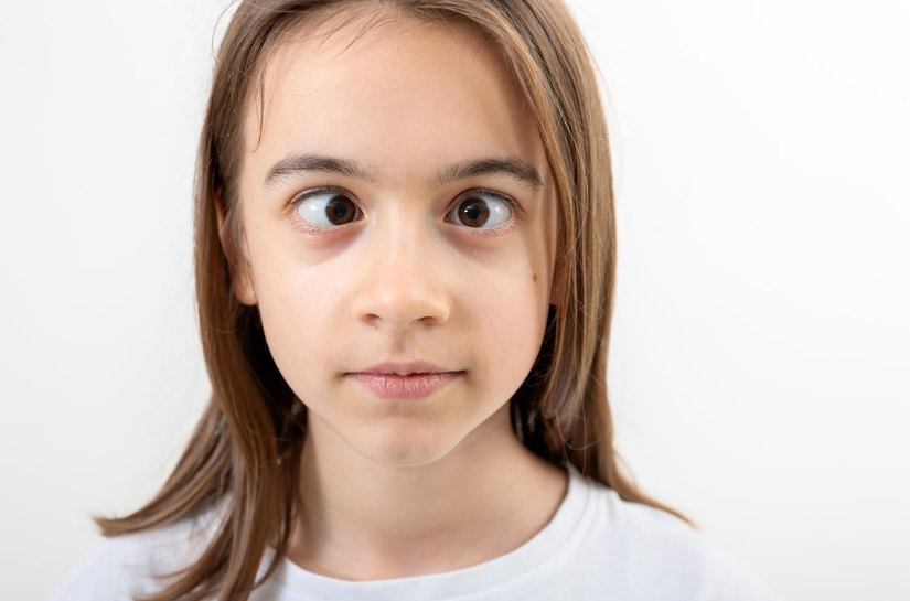 Fique atento se seus olhos diferem no tamanho, formato ou alinhamento