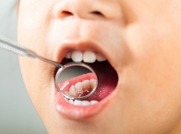 Saúde bucal infantil: 5 dicas para começar os cuidados desde cedo