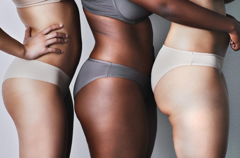 Dia do Combate à Celulite reforça que o problema vai além da estética e afeta a saúde de milhões de mulheres