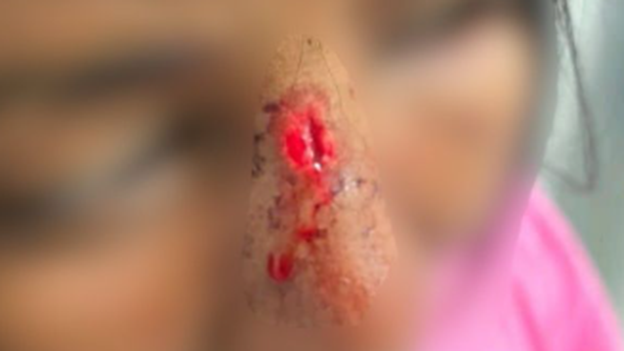 Polícia prende homem que espancou mulher com chutes na cabeça e rosto em Campo Alegre