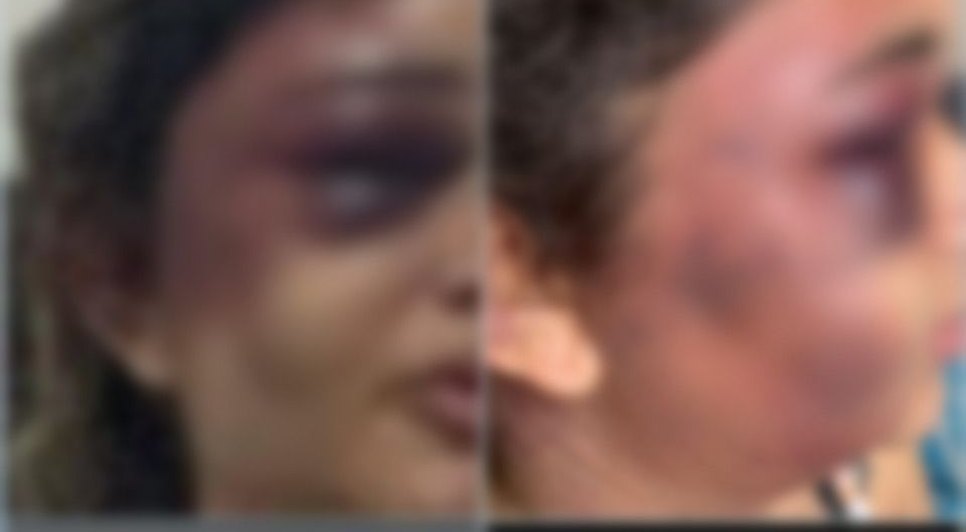 Mulher é espancada pelo ex-companheiro na frente dos filhos em Aracaju