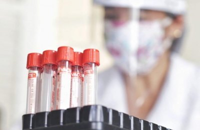 Palmeira ocupa a posição 55 entre cidades com maior índice de infestação da Covid