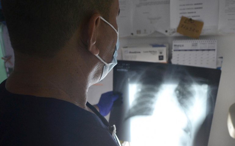 Dia Mundial de Combate à Tuberculose: doença pode atingir outros órgãos além do pulmão