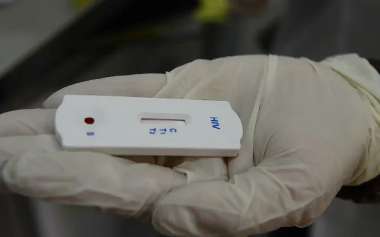 Saúde orienta farmácias sobre testes para HIV, sífilis e hepatites