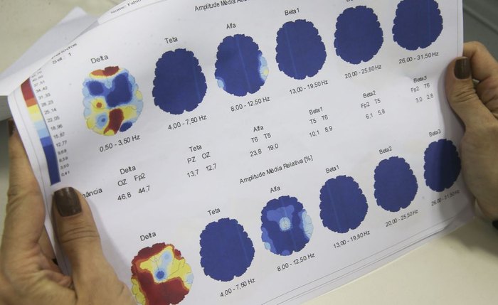 Campanha é promovida pela Associação Brasileira de Epilepsia Campanha é promovida pela Associação Brasileira de Epilepsia