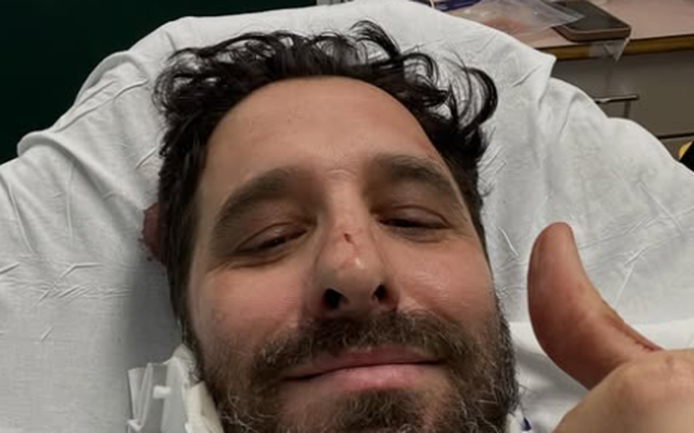 Rafinha Bastos sofre acidente de bicicleta em Nova York e fratura clavícula