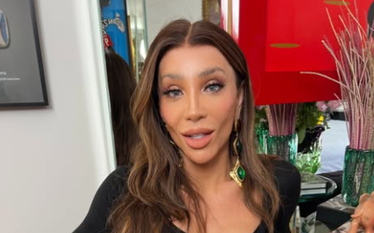 Rosto de Maya Massafera infecciona após cirurgia no maxilar: 'Não consigo parar de chorar'