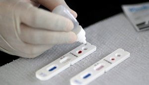 teste coronavirus