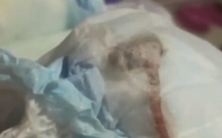 Mãe encontra rato morto dentro de fralda do filho; Delegacia do Consumidor do Rio investiga