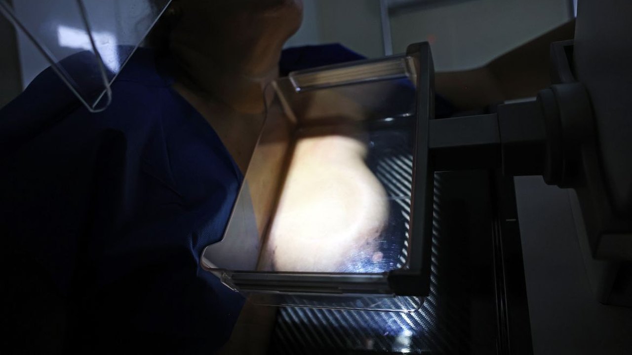 Campanha do MS busca aumentar diagnóstico precoce do câncer de mama