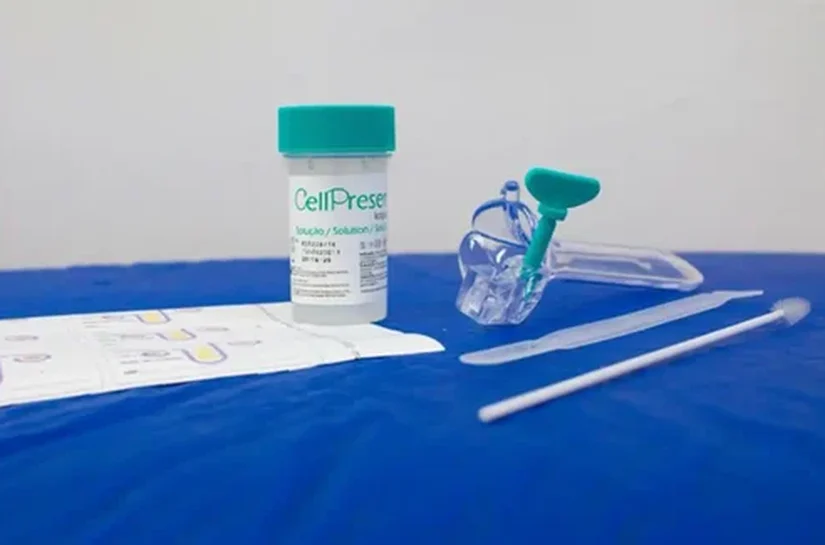 SUS detecta quase 10 mil testes positivos para HPV de alto risco