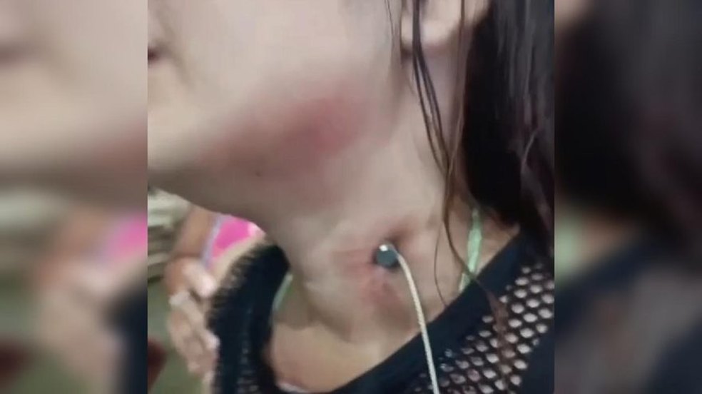 Jovem é agredida com prego cravado no pescoço pelo namorado em Cametá (PA); agressor está foragido