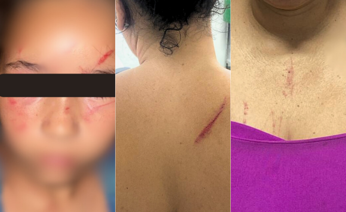 A mulher e a criança apresentavam lesões visíveis no rosto e em várias partes do corpo A mulher e a criança apresentavam lesões visíveis no rosto e em várias partes do corpo