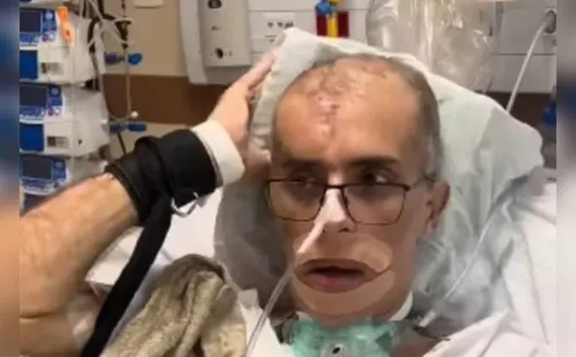 Piloto alagoano baleado na cabeça deixa CTI após oito meses