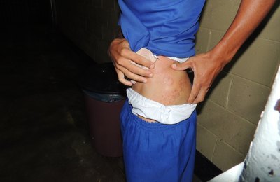 26 de junho é o Dia Internacional de Apoio às Vítimas da Tortura