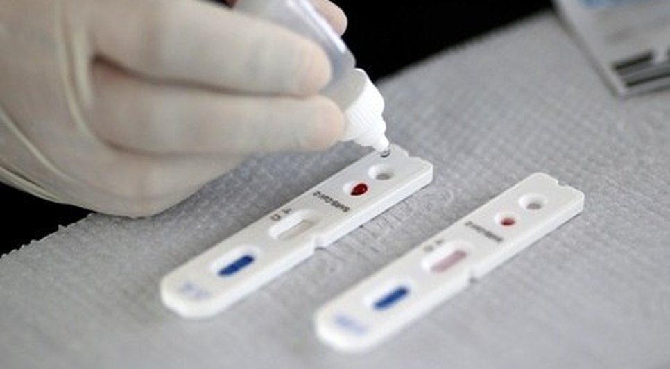 teste coronavirus