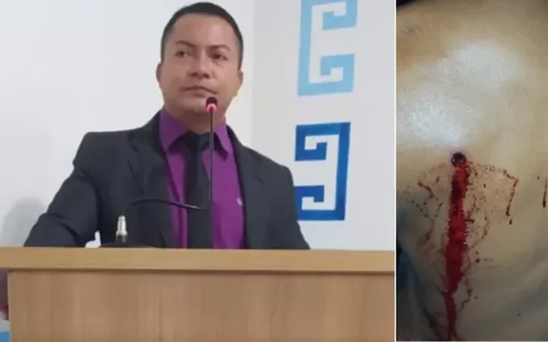 Vereador do Pará suspeito de atirar contra assentado tem prisão mantida após audiência de custódia