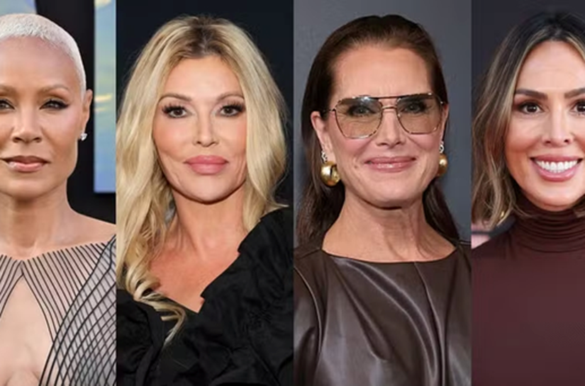 Divórcio, autoestima e autocuidado: os motivos que levaram famosas a recorrer à harmonização íntima