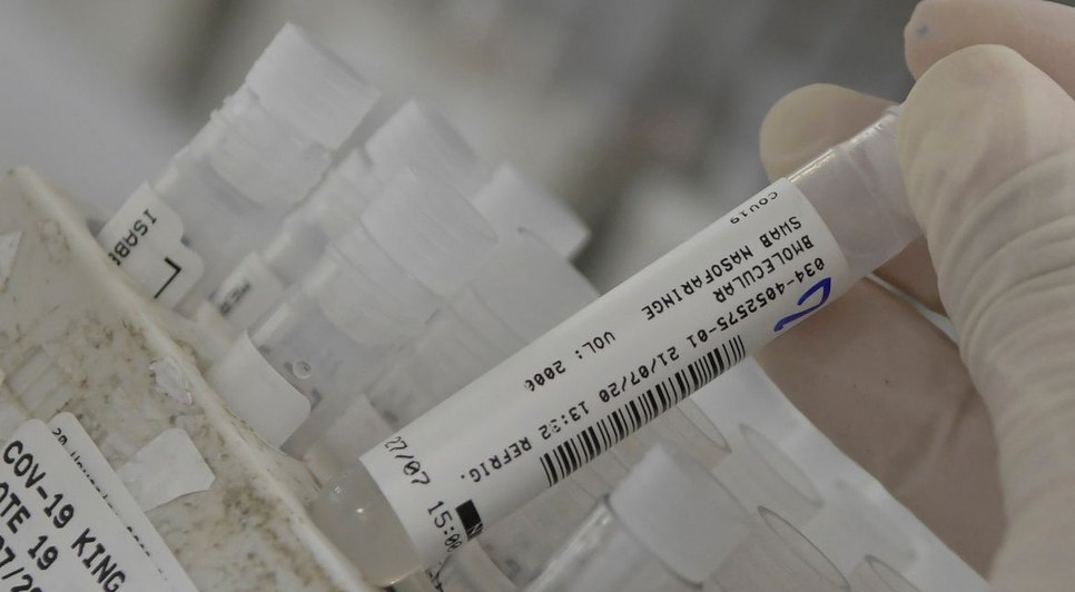 2020-07-24t143211z_1391278467_rc2qzh93g22g_rtrmadp_3_health-coronavirus-brazil.jpg