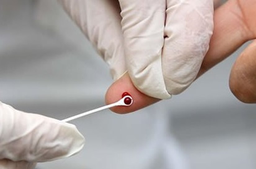 Casos de Aids caem 400% em Arapiraca nos últimos cinco anos