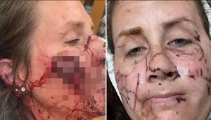 ataque-lontra-mulher-ferimento-15082023171105842