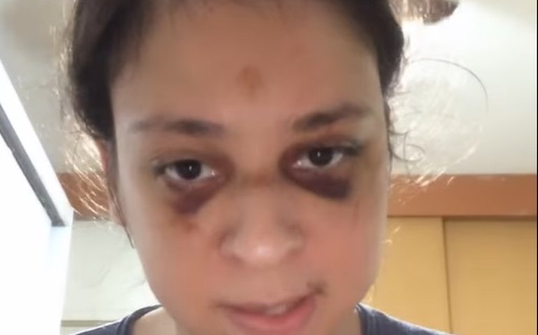 'Pedia desesperadamente para ele parar', diz ator Victor Meyniel sobre agressão no Rio