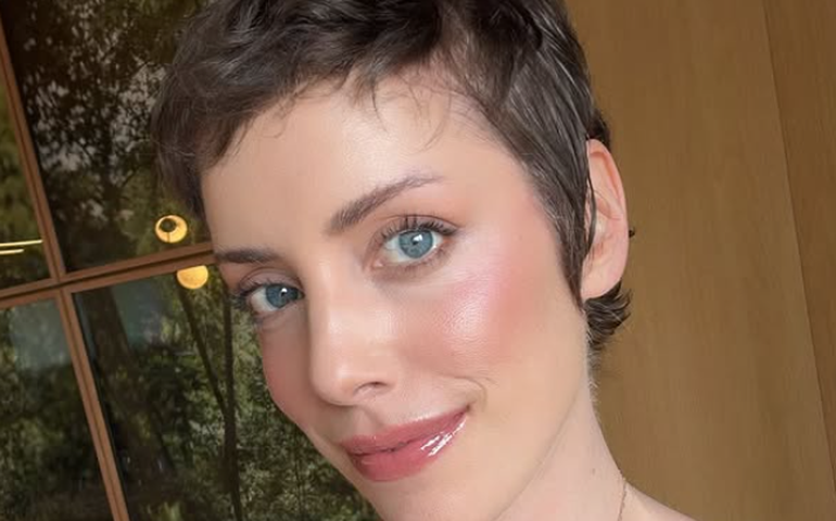 Fabiana Justus inicia novo tratamento após transplante de medula óssea