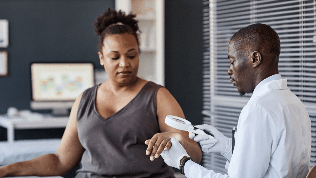 Câncer de pele: a importância das consultas após a retirada do tumor