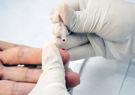 Hospital Helvio Auto fará testes para detectar HIV e sífilis abertos à população