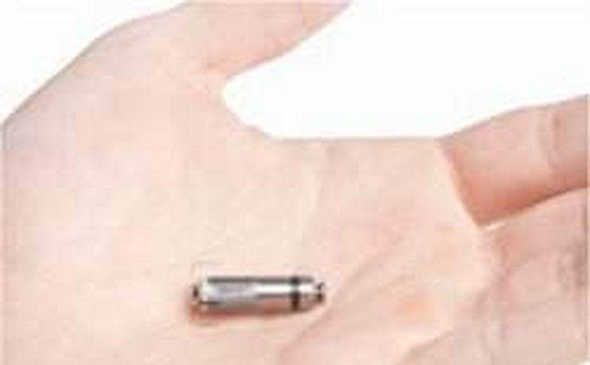 Do tamanho de uma pílula, menor marcapasso do mundo é implantado sem cirurgia