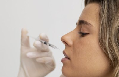 Quais áreas do corpo podem receber aplicação de preenchedores?