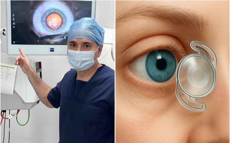 Lente intraocular criada por médico alagoano chega ao Brasil e promete revolucionar cirurgias de catarata