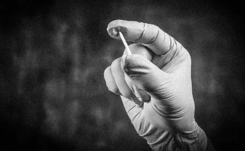 Chip da beleza e outros: por que o CFM proibiu o uso de esteroides