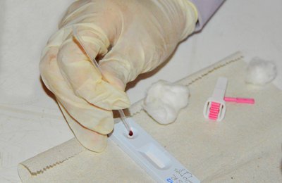 Secretaria de Estado da Saúde orienta sobre prevenção e tratamento da sífilis