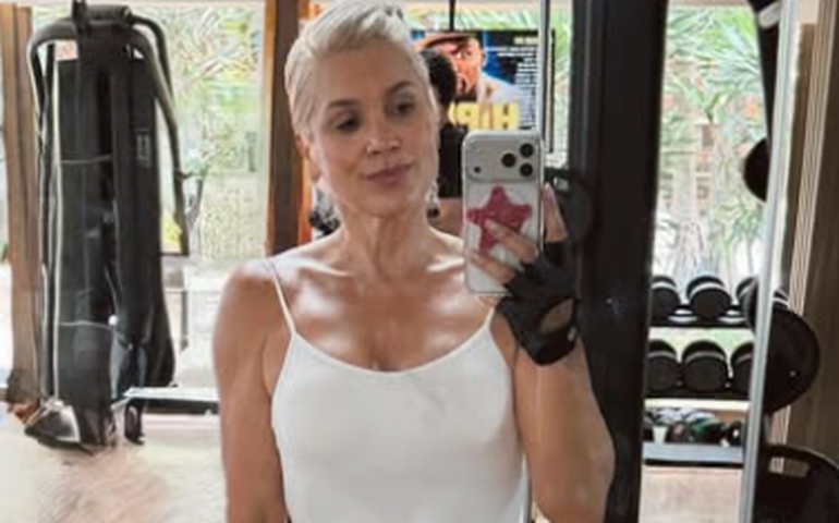 Flávia Alessandra detalha diagnóstico da síndrome de ombro congelado, causada pela menopausa
