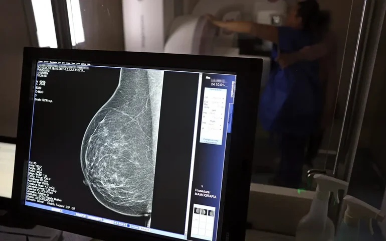 Lei garante mamografia pelo SUS a mulheres a partir de 40 anos