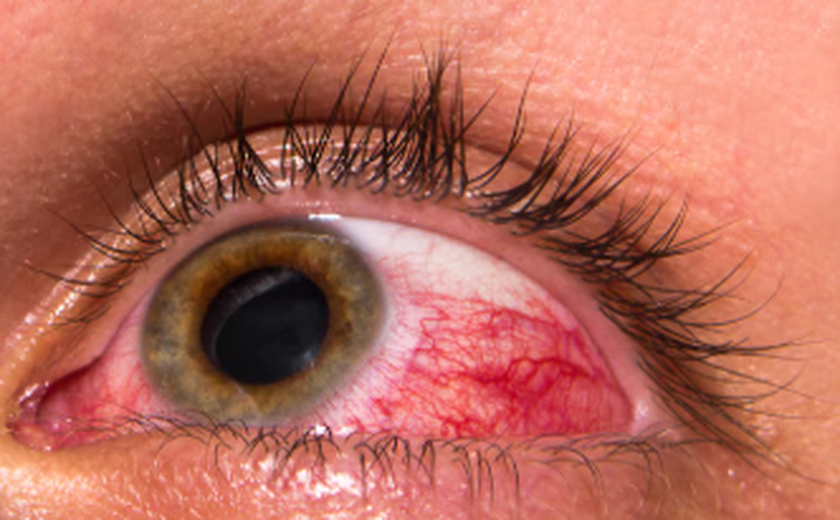 Seus olhos estão te dando um alerta?
