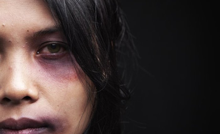 Sancionada lei que prevê plástica no SUS para mulher vítima de violência Sancionada lei que prevê plástica no SUS para mulher vítima de violência