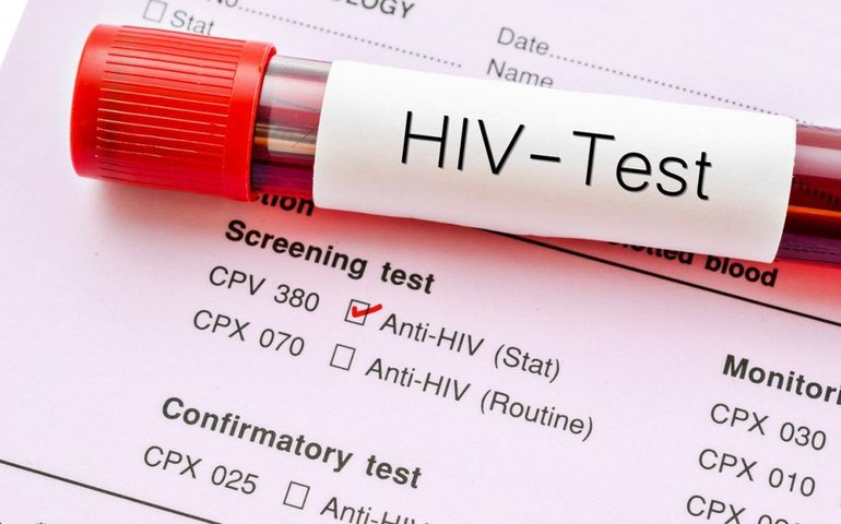 Pandemia provoca redução de consultas e exames de HIV