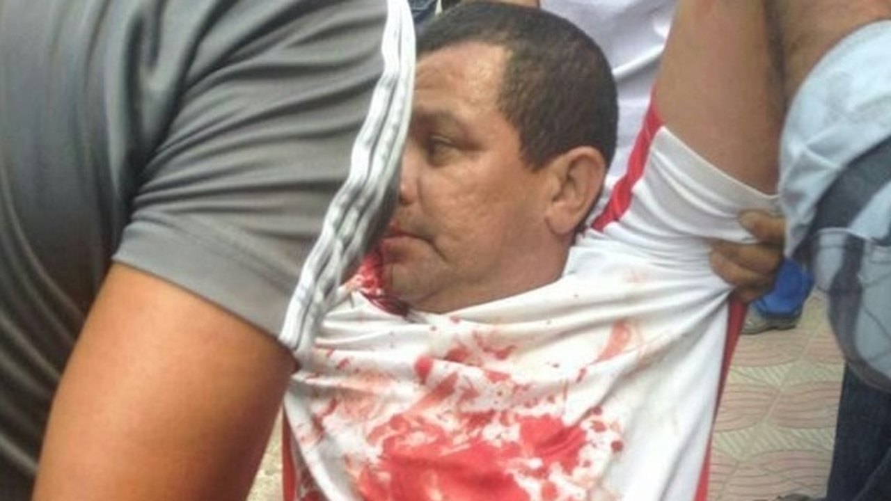 Policial militar é baleado ao tentar evitar assalto em União dos Palmares