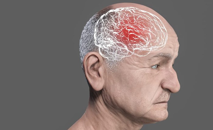 Até 2050, o número de brasileiros vivendo com demência deve aumentar 206% Até 2050, o número de brasileiros vivendo com demência deve aumentar 206%