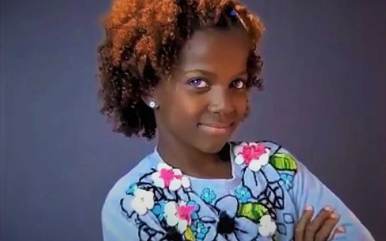 Menina com síndrome rara vence concurso de beleza no Mississippi