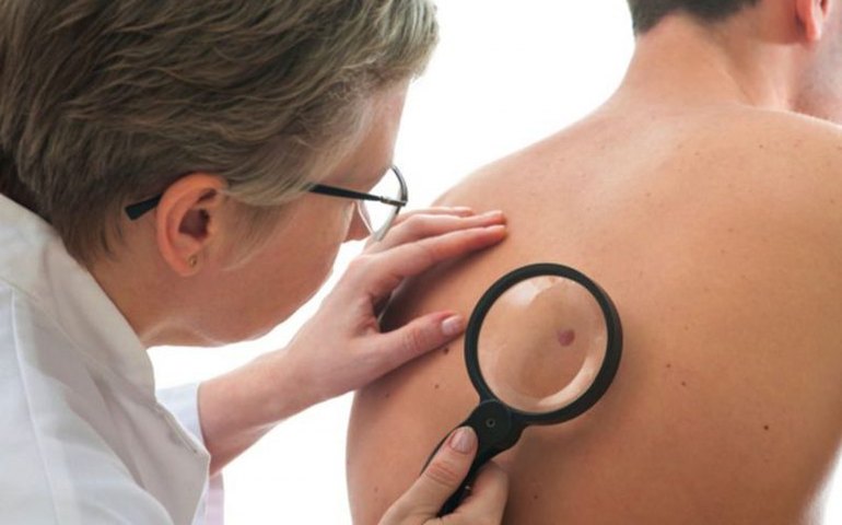 Seminário debate prevenção, diagnóstico e tratamento do câncer de pele no Brasil