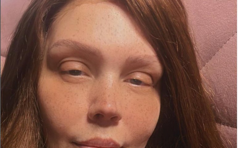 Simony posta foto após fim da quimioterapia: 'Sem cílios, com lace ruiva e o coração agradecido'