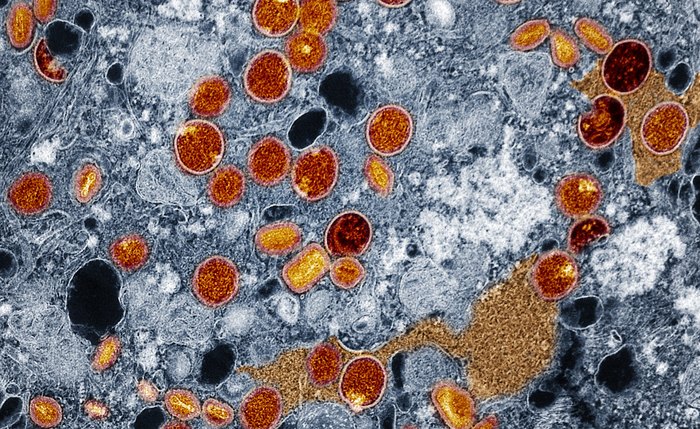 Micrografia eletrônica de transmissão colorida de partículas do vírus mpox (verde)