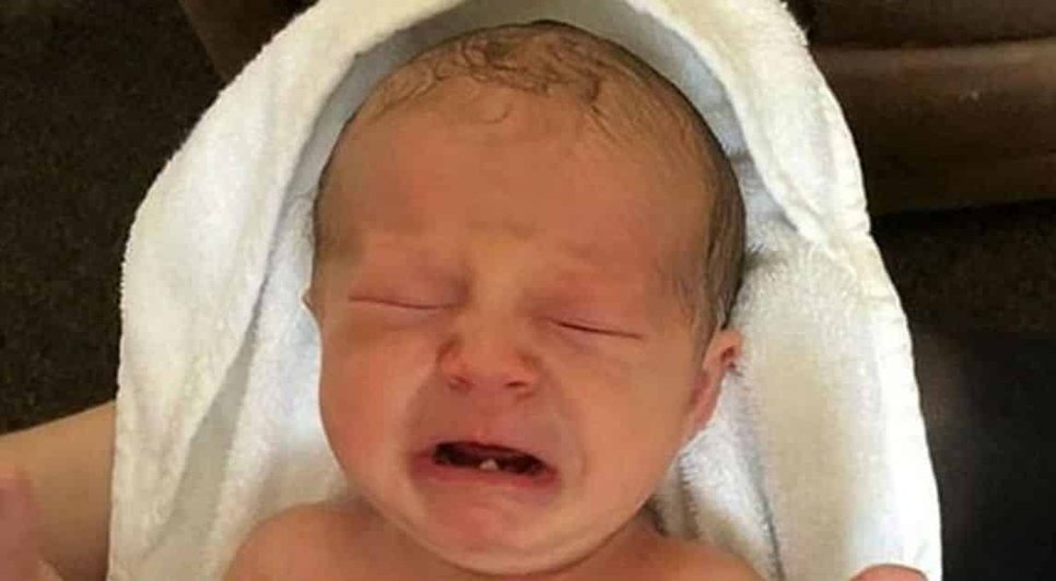 Bebê nasce com dente / Foto: Reprodução Daily Mail