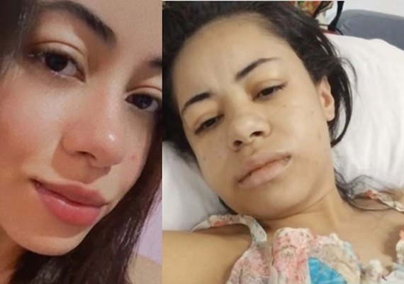 Jovem alagoana precisa de ajuda para custear tratamento de doença rara